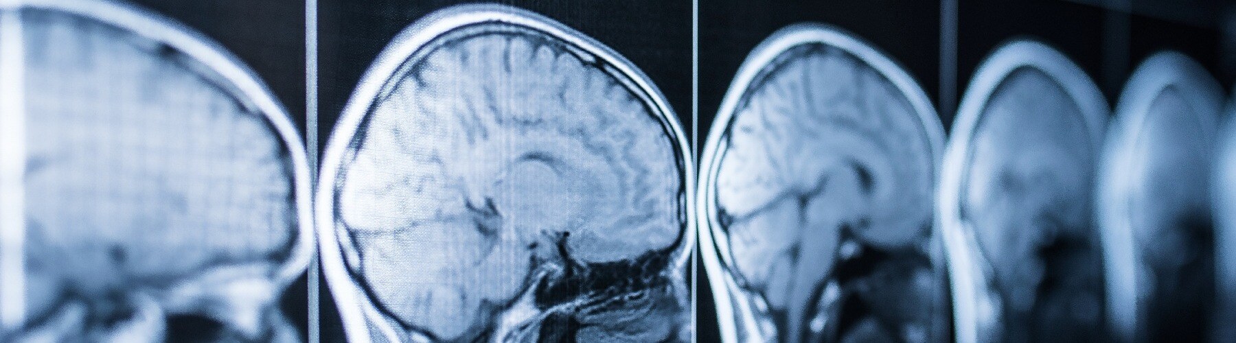 brain scans related to peptide production