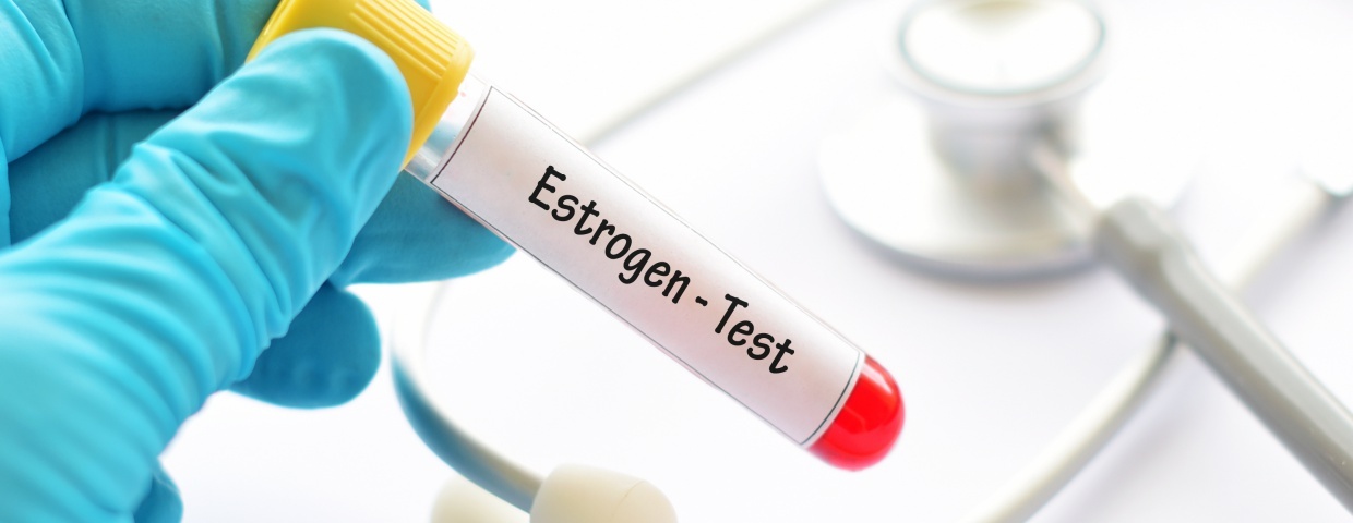 estrogen level testing